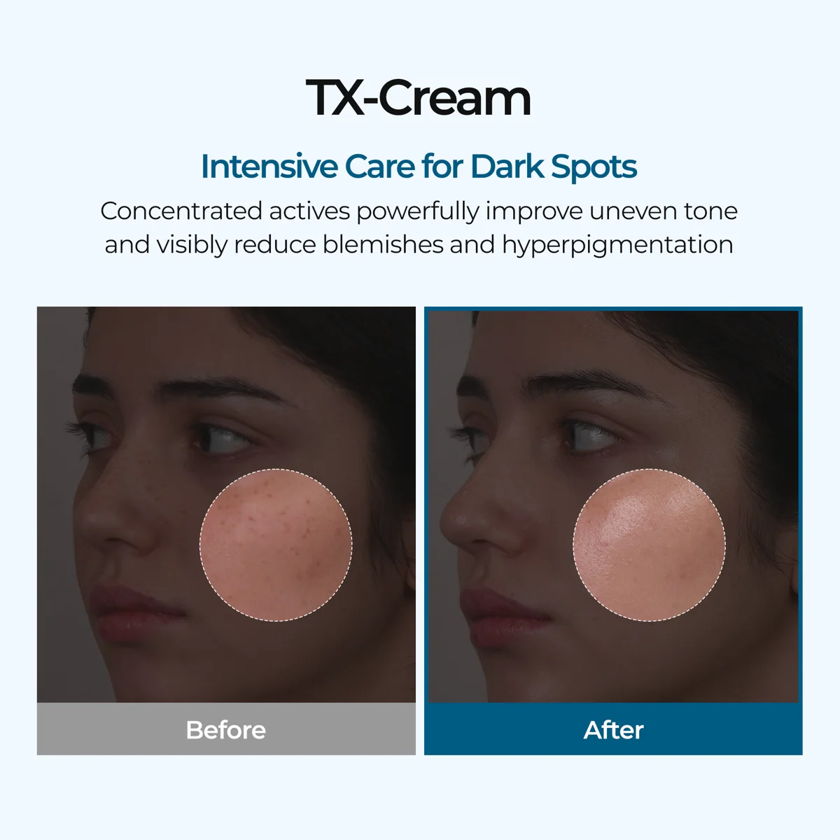 Dr. Melaxin TX Cream 50 ml