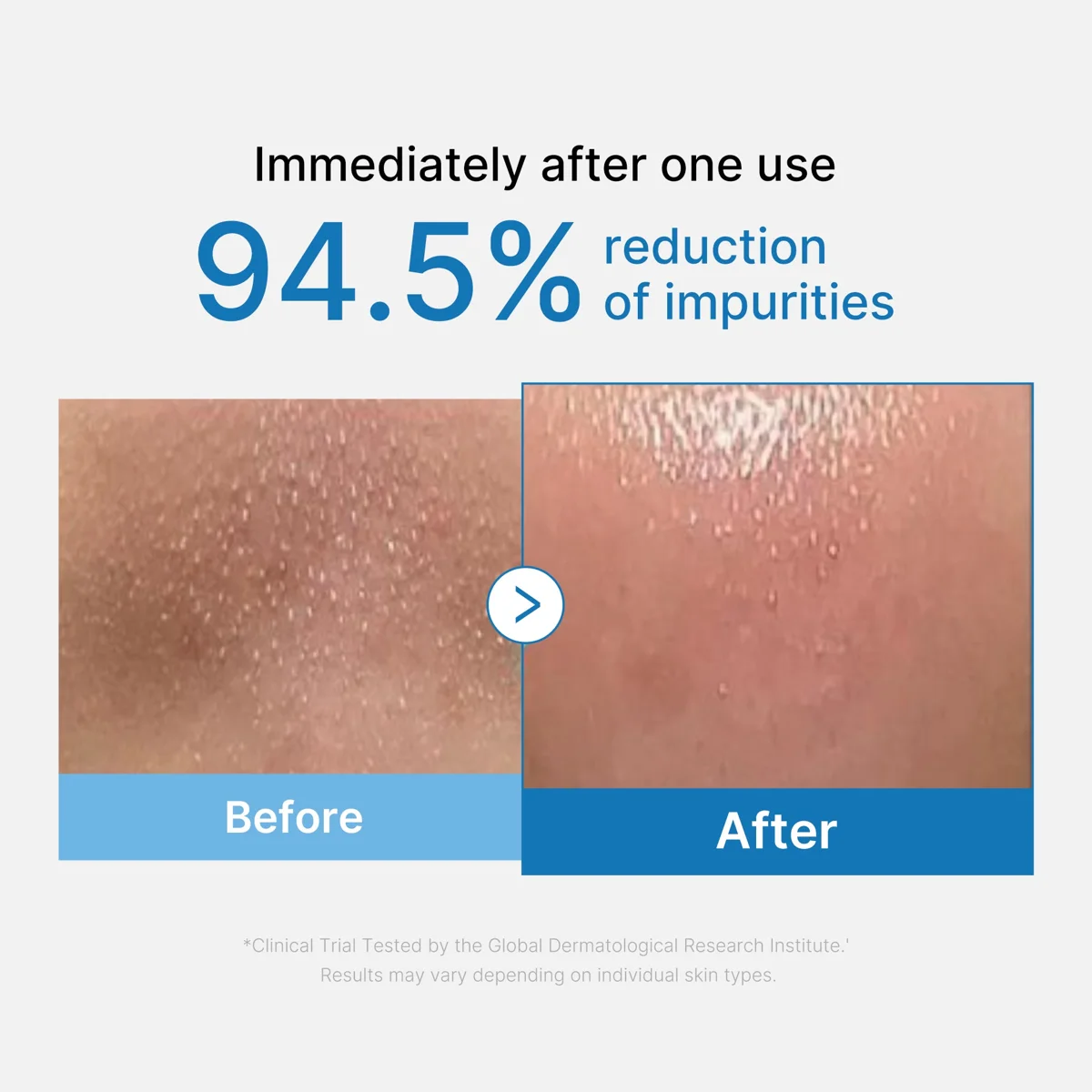 Medicube Zero Pore Blackhead Deep Cleansing Oil 205 ml