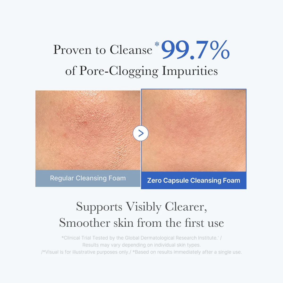 Medicube Zero Pore SA Clear Capsule Cleansing Foam 120 g